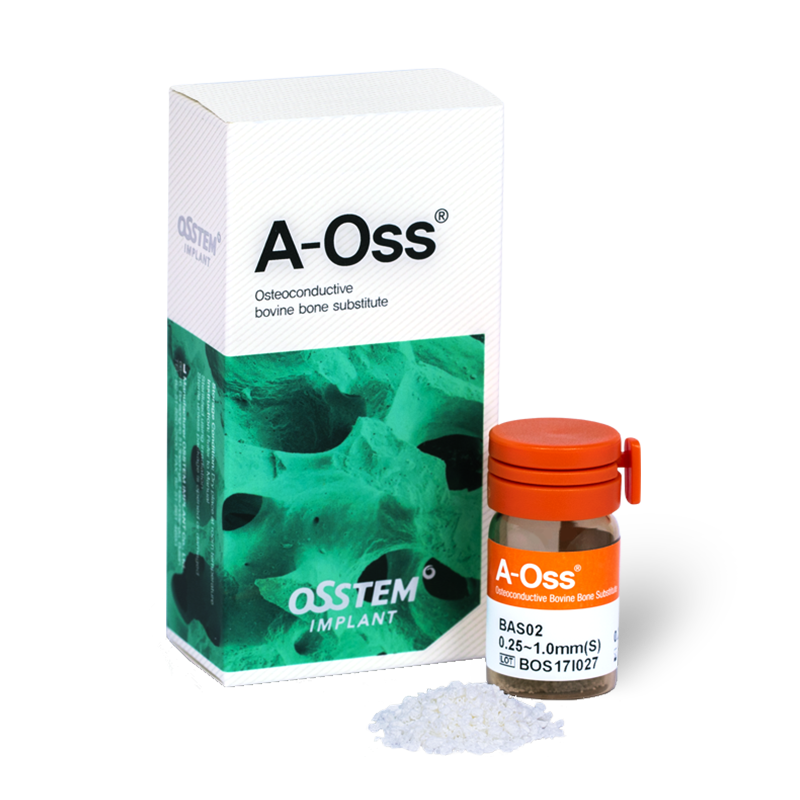 A-Oss