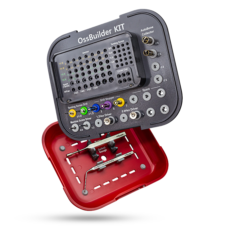 OssBuilder Kit