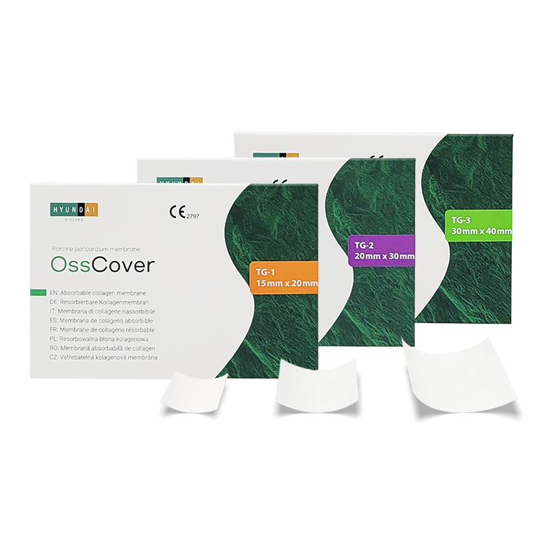 OssCover