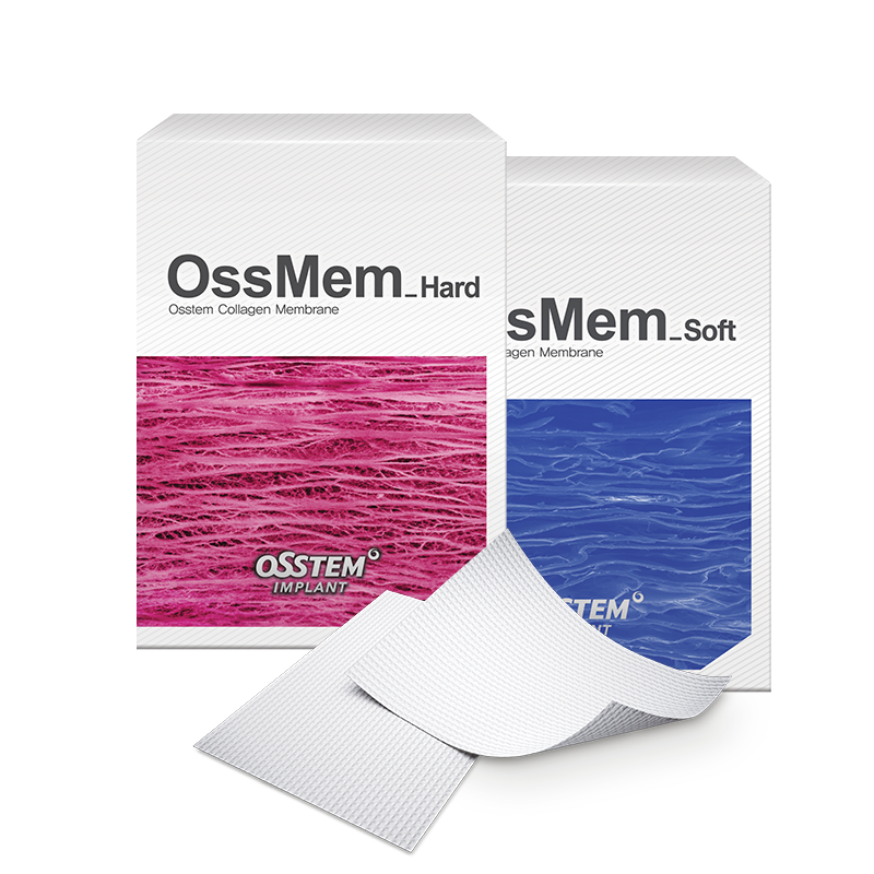 OssMem
