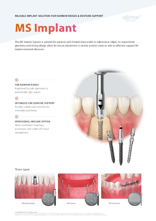Flyer | MS Implant System | English