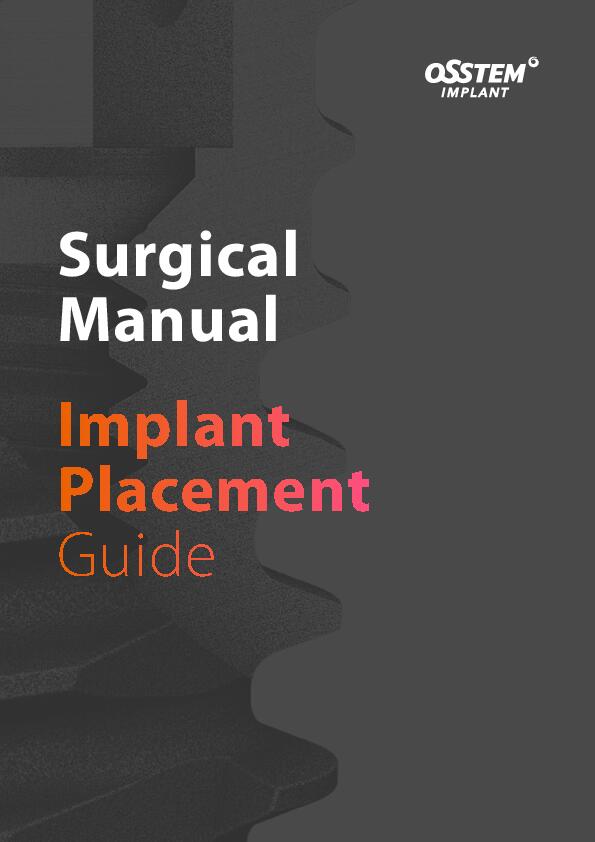 Surgical-Manual | Implant Placement Guide | English
