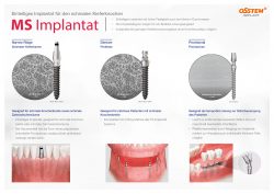 20211112_MS-Implant_ger-thumbnail.jpg