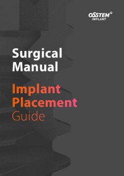 Surgical-Manual-EU_Implants_Implant-Placement_en-thumbnail.jpg